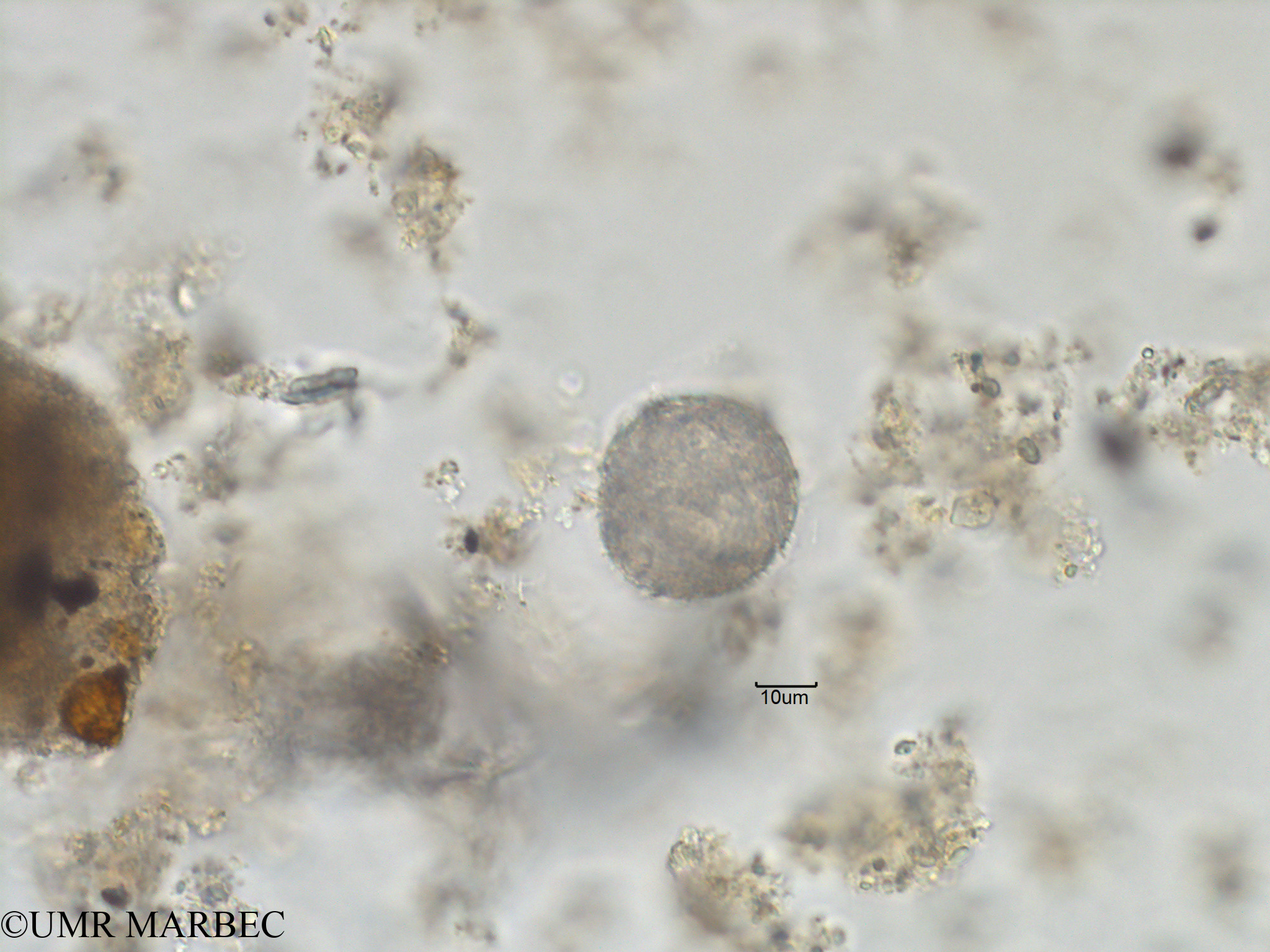 phyto/Bizerte/bizerte_bay/RISCO November 2015/Gonyaulax spinifera (Baie_T1C-Gonyaulax cf polygramma-9).tif(copy).jpg